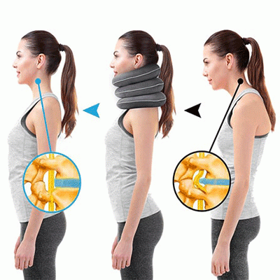 وضعیت گردن قبل و بعد از استفاده از گردنبند طبی بادی