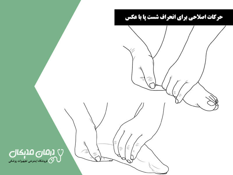 حرکات اصلاحی برای انحراف شست پا با عکس