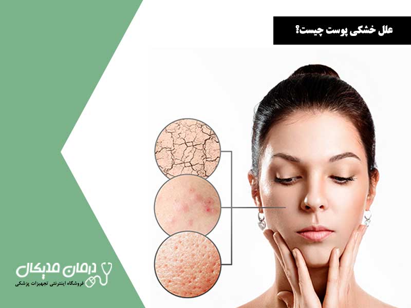 علل خشکی پوست چیست؟