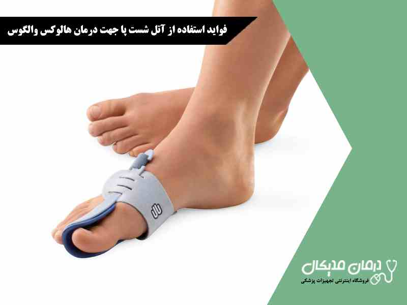 فواید استفاده از آتل شست پا جهت درمان هالوکس والگوس